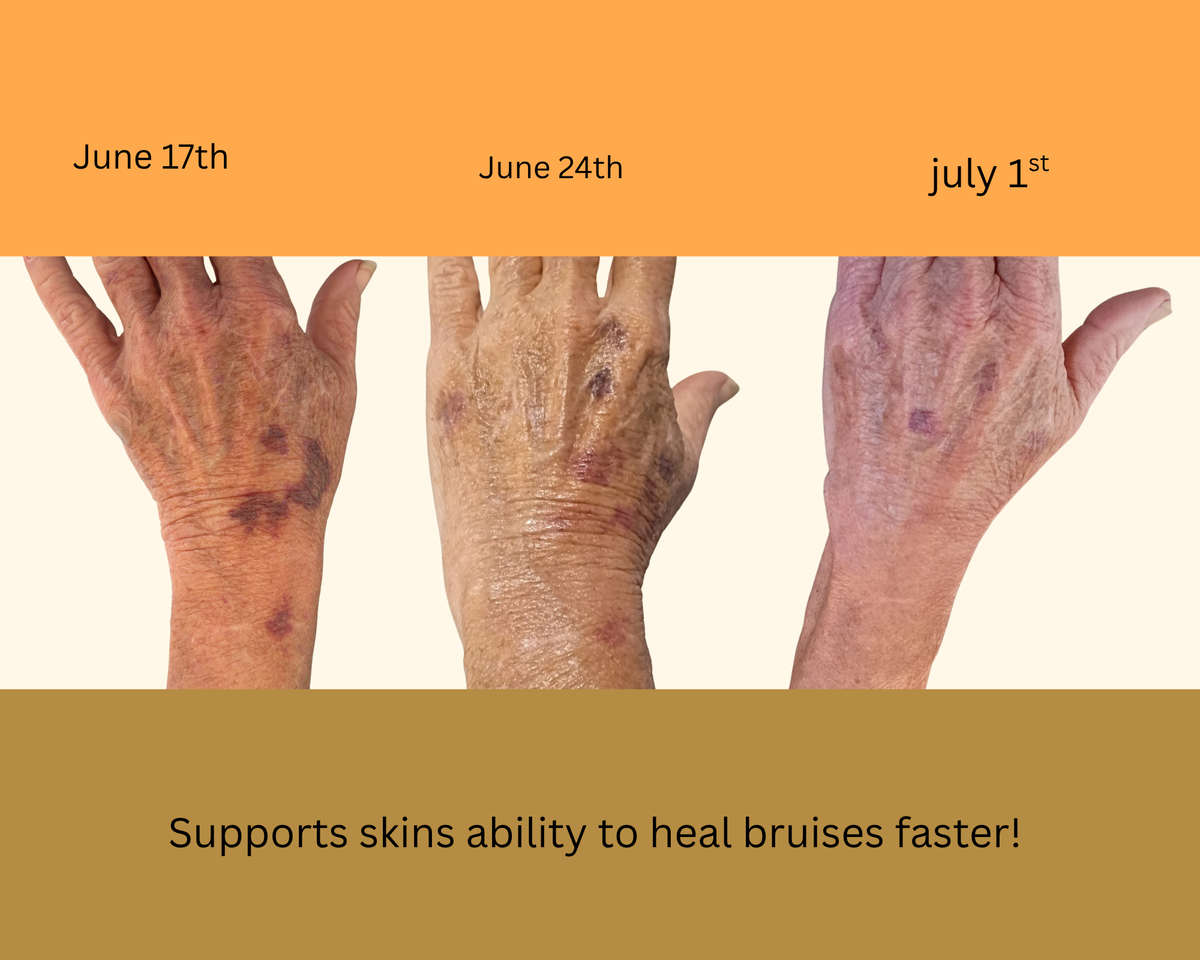 Anti Aging Body Butter (Original-Skin Essentials).